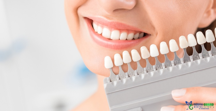 اسعار الكراون للاسنان 2025